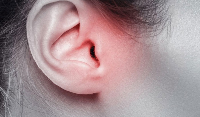 میگرن وستیبولار چگونه تشخیص داده میشود؟