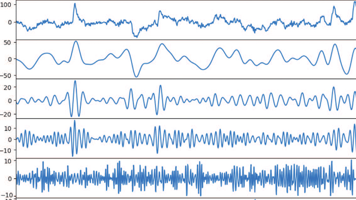 eeg