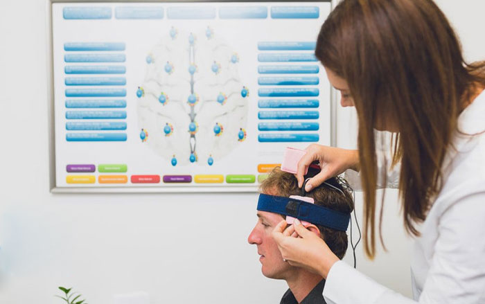 انجام tdcs