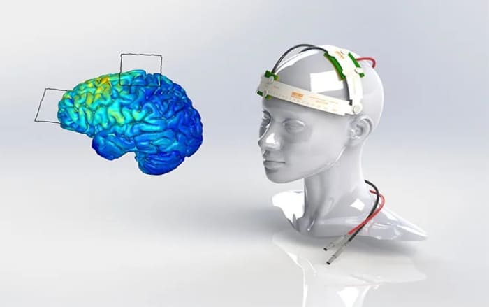 تحریک الکتریکی از روی جمجمه
