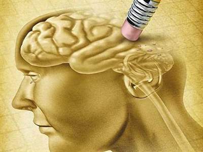 آلزایمر چیست و چه علائمی دارد؟