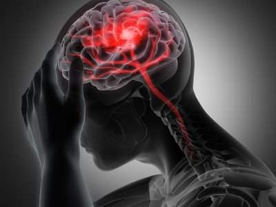 آنسفالیت مغزی چیست و چه عوارضی دارد
