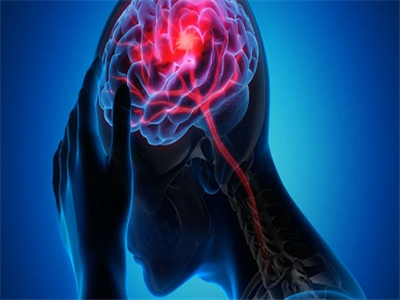 طول عمر بعد از سکته مغزی چقدر است؟