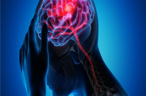 طول عمر بعد از سکته مغزی چقدر است؟