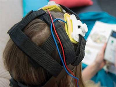 تحریک الکتریکی مغز با روش tdcs