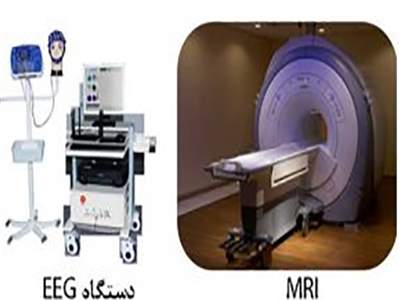 تفاوت MRI و نوار مغزی